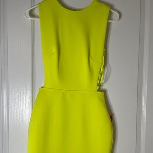 ASOS neon yellow scuba dress.